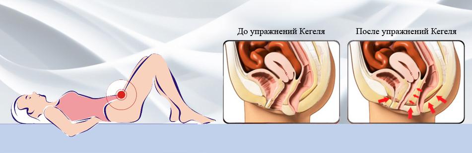 упражнение кегеля